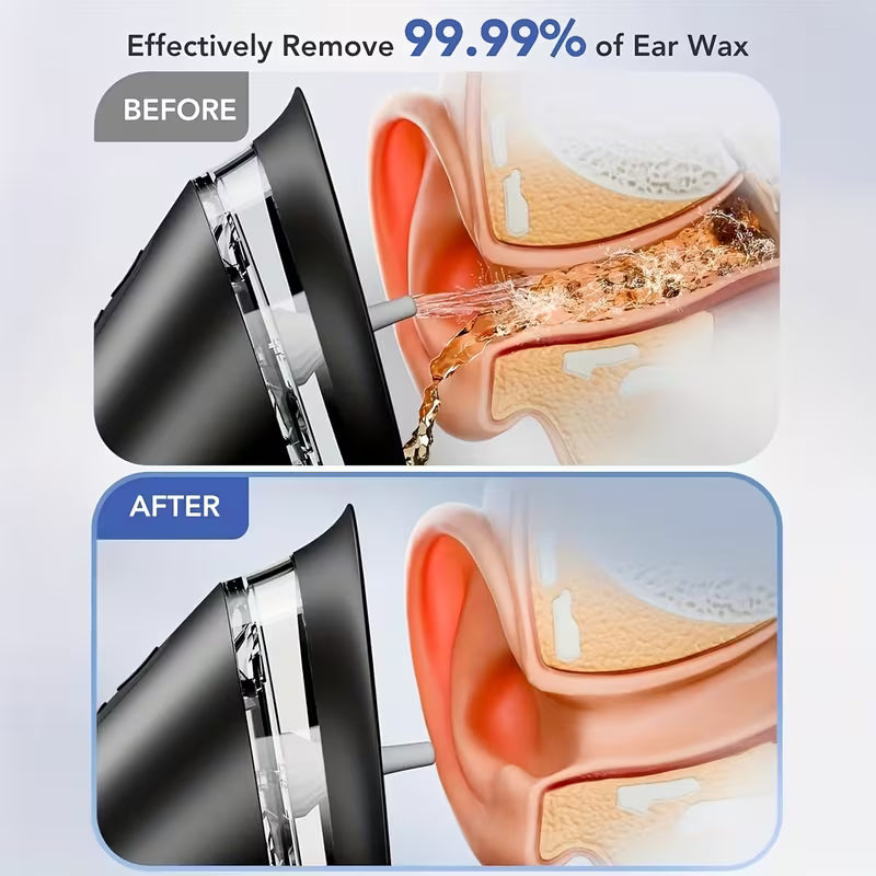 Safe Electric Ear Cleaning Kit Pro