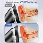Safe Electric Ear Cleaning Kit Pro